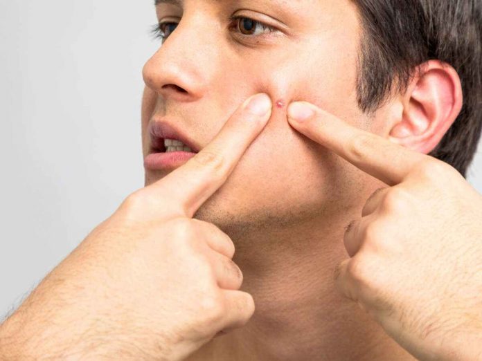 How to get rid of pimples?